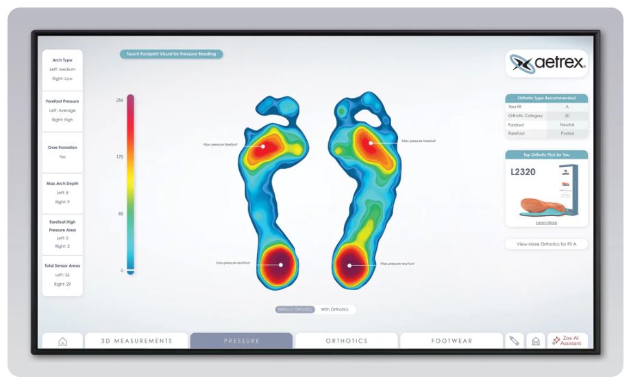 Aetrex pressure map screen showing high-pressure areas on both feet